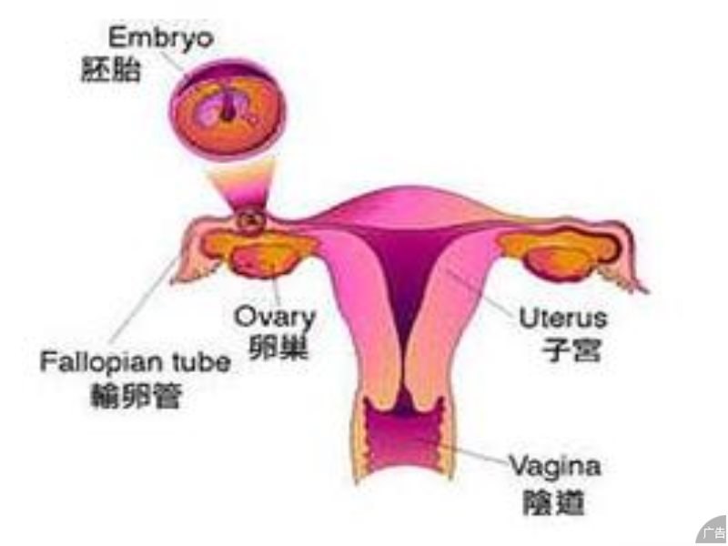 治疗卵巢性不孕哪个医院较好