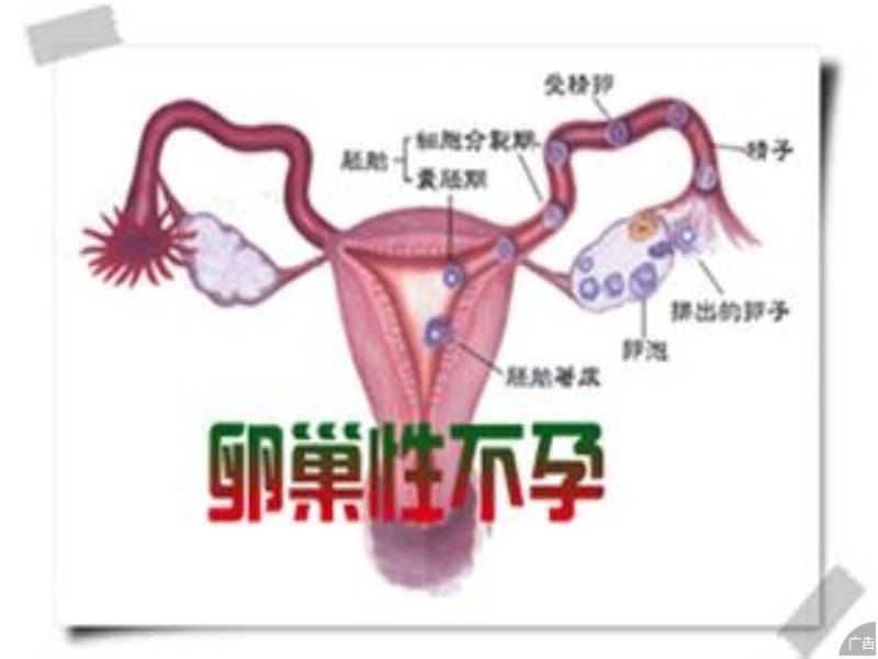 导致女性巢性不孕的原因有哪些